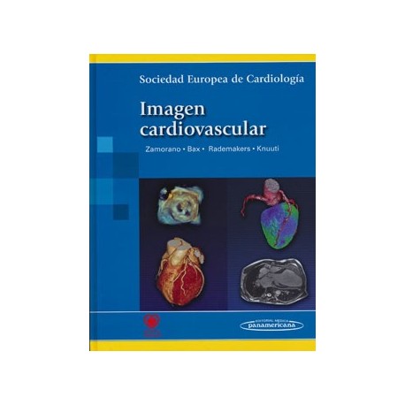 IMAGEN CARDIOVASCULAR