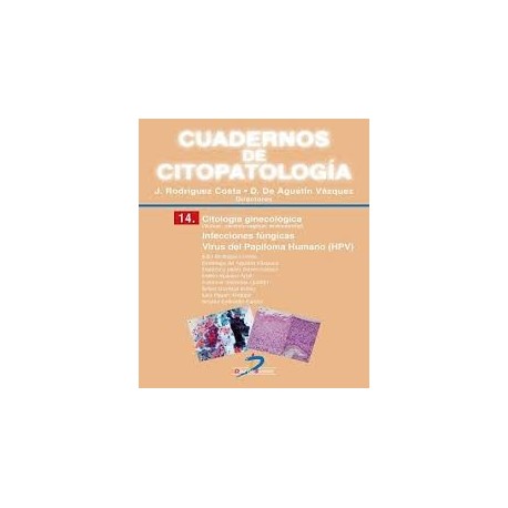 CUADERNOS DE CITOPATOLOGIA 14 (CITOLOGIA GINECOLOGICA.INFECCIONES FUNGICAS. VIRUS DEL PAPILOMA HUMANO)