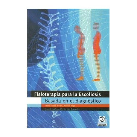 FISIOTERAPIA PARA LA ESCOLIOSIS BASADA EN EL DIAGNOSTICO