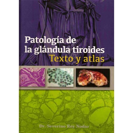 PATOLOGIA DE LA GLANDULA TIROIDES. TEXTO Y ATLAS