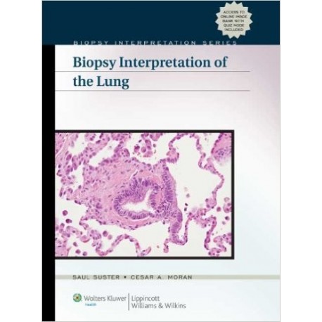 BIOPSY INTERPRETATION OF THE LUNG