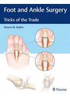 FOOT AND ANKLE SURGERY. TRICKS OF THE TRADE