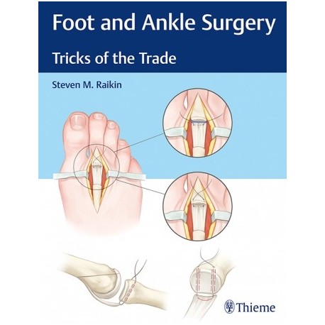 FOOT AND ANKLE SURGERY. TRICKS OF THE TRADE