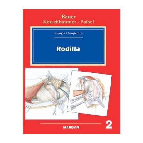 CIRUGIA ORTOPEDICA 2 RODILLA