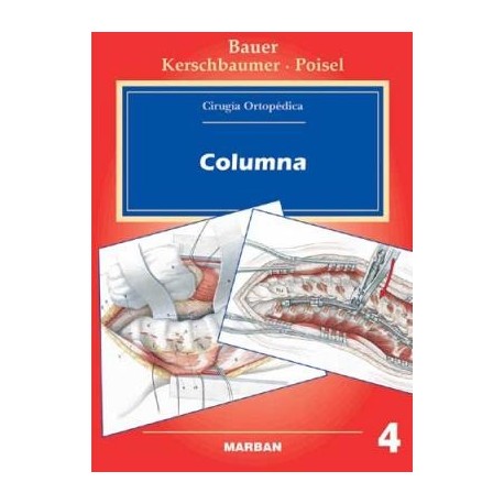 CIRUGIA ORTOPEDICA 4 COLUMNA