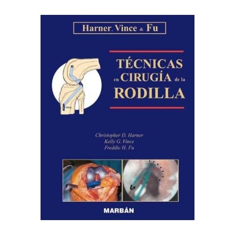 TECNICAS EN CIRUGIA DE LA RODILLA