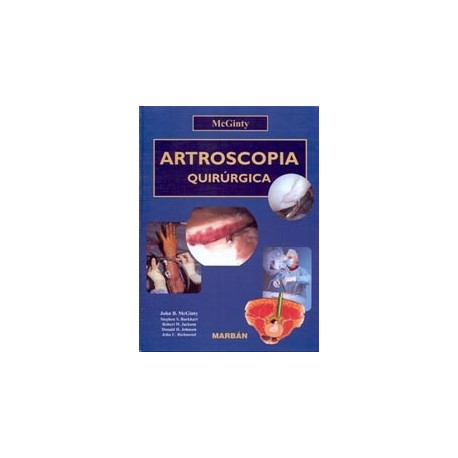 ARTROSCOPIA QUIRURGICA