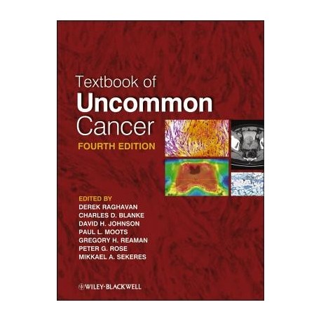 TEXTBOOK OF UNCOMMON CANCER