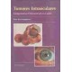 TUMORES INTRAOCULARES. DIAGNOSTICO DIFERENCIAL EN COLOR