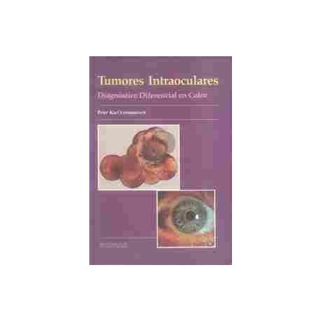 TUMORES INTRAOCULARES. DIAGNOSTICO DIFERENCIAL EN COLOR