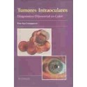 TUMORES INTRAOCULARES. DIAGNOSTICO DIFERENCIAL EN COLOR