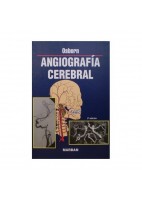 ANGIOGRAFIA CEREBRAL