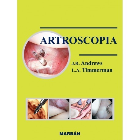 ARTROSCOPIA