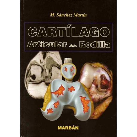 CARTILAGO ARTICULAR DE LA RODILLA