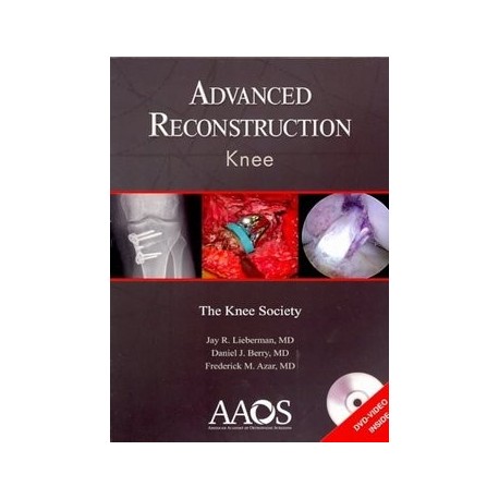 ADVANCED RECONSTRUCTION KNEE + DVD