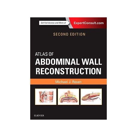 ATLAS OF ABDOMINAL WALL RECONSTRUCTION