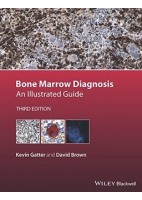 BONE MARROW DIAGNOSIS