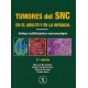 TUMORES DEL SNC EN EL ADULTO Y EN LA INFANCIA