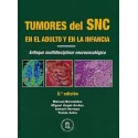 TUMORES DEL SNC EN EL ADULTO Y EN LA INFANCIA