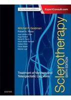 SCLEROTHERAPY