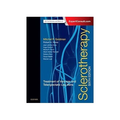 SCLEROTHERAPY