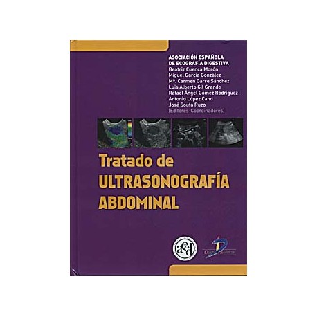 TRATADO DE ULTRASONOGRAFIA ABDOMINAL