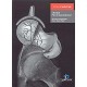 CHOQUE FEMOROACETABULAR