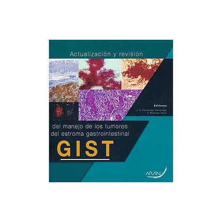 ACTUALIZACION Y REVISION DEL MANEJO DE LOS TUMORES DEL ESTROMA GASTROINTESTINAL GIST
