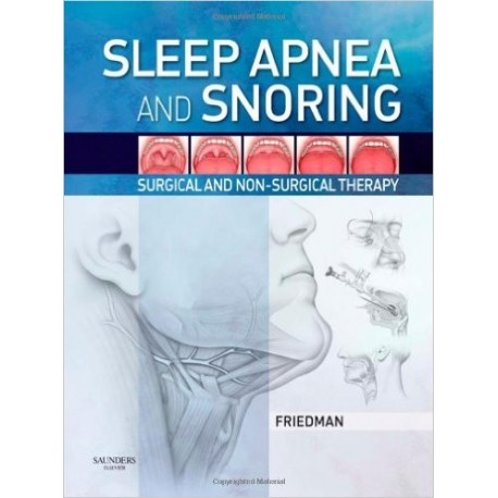 SLEEP APNEA AND SNORING. SURGICAL AND NON-SURGICAL THERAPY