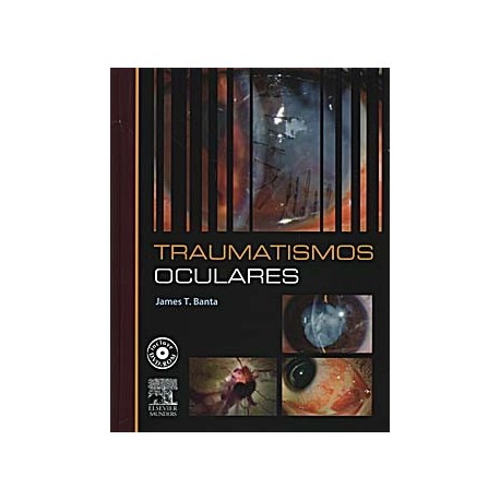 TRAUMATISMOS OCULARES + CD