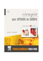 CIRUGIA PARA ARTROSIS DE CADERA
