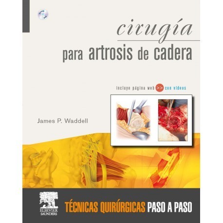 CIRUGIA PARA ARTROSIS DE CADERA