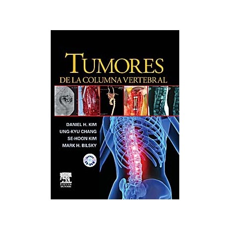 TUMORES DE LA COLUMNA VERTEBRAL