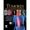 TUMORES DE LA COLUMNA VERTEBRAL