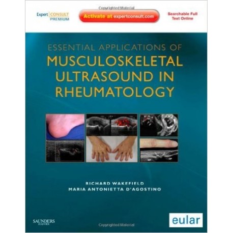 ESSENTIAL APPLICATIONS OF MUSCULOSKELETAL ULTRASOUND IN RHEUMATOLOGY PREMIUM EDITION (ONLINE AND PRINT)