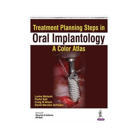 TREATMENT PLANNING STEPS IN ORAL IMPLANTOLOGY. A COLOR ATLAS