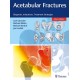 ACETABULAR FRACTURES. DIAGNOSIS, INDICATIONS, TREATMENT STRATEGIES