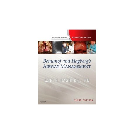BENUMOF AND HAGBERG'S AIRWAY MANAGEMENT