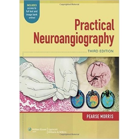 PRACTICAL NEUROANGIOGRAPHY