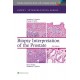 BIOPSY INTERPRETATION OF THE PROSTATE