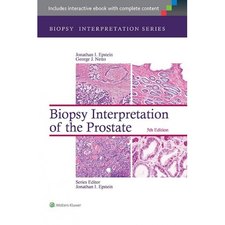 BIOPSY INTERPRETATION OF THE PROSTATE