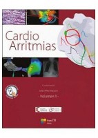 CARDIO ARRITMIAS (VOL.2)