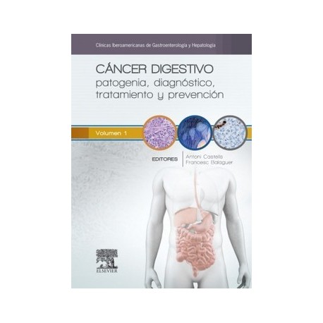 CANCER DIGESTIVO. PATOGENIA, DIAGNOSTICO, TRATAMIENTO Y PREVENCION