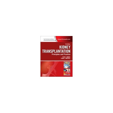 KIDNEY TRANSPLANTATION. PRINCIPLES AND PRACTICE