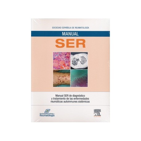 MANUAL SER DE DIAGNOSTICO Y TRATAMIENTO DE LAS ENFERMEDADES REUMATICAS AUTOINMUNES SISTEMICAS