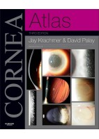 CORNEA ATLAS