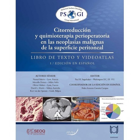 CITORREDUCCION Y QUIMIOTERAPIA PERIOPERATORIA EN LAS NEOPLASIAS MALIGNAS DE LA SUPERFICIE PERITONEAL