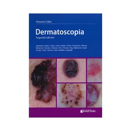DERMATOSCOPIA