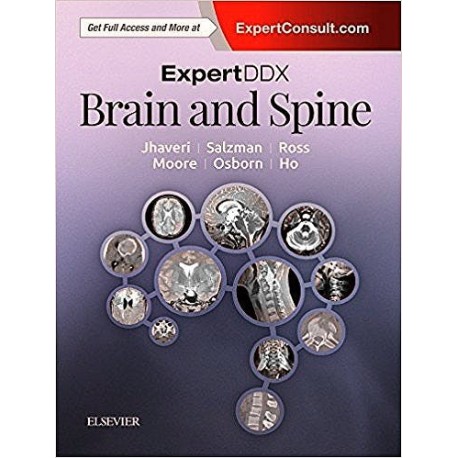 EXPERTDDX BRAIN AND SPINE