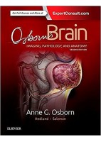 OSBON'S BRAIN. IMAGING, PATHOLOGY AND ANATOMY